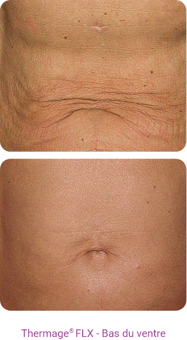 Grille de répétition 1